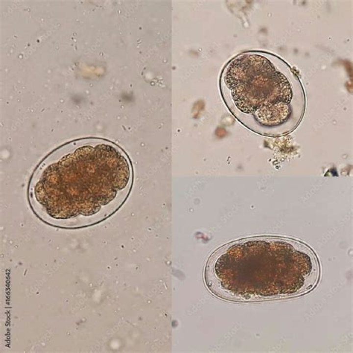 Are parasite eggs visible?