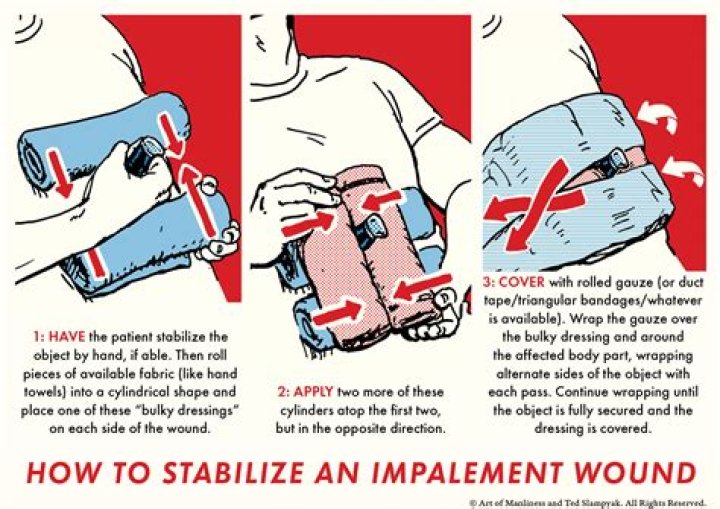 At does impale mean?