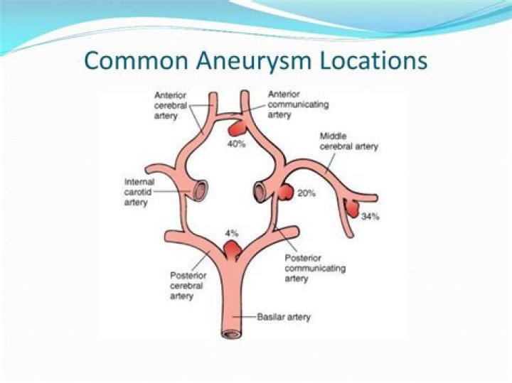 At which junction are aneurysms most common?