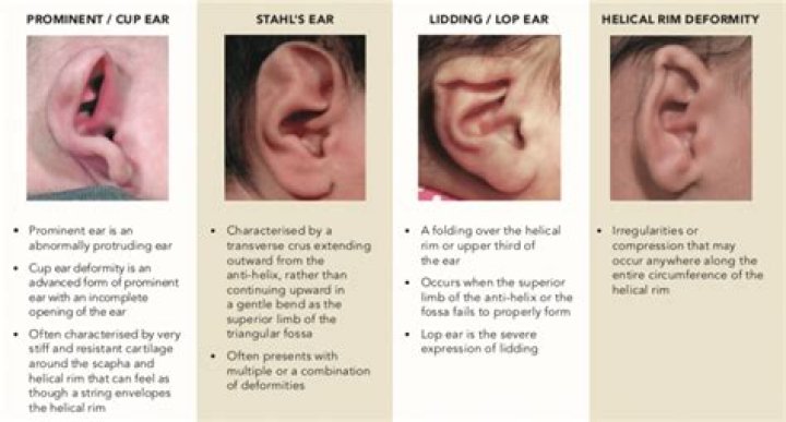 Can ear lidding correct itself?