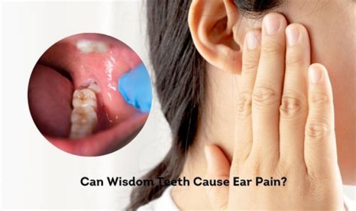 Can wisdom teeth cause ear pain?