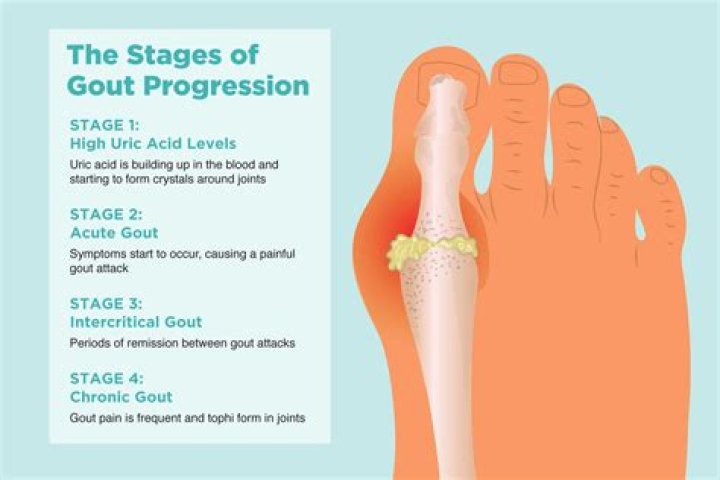 Can you get gout in your knee?