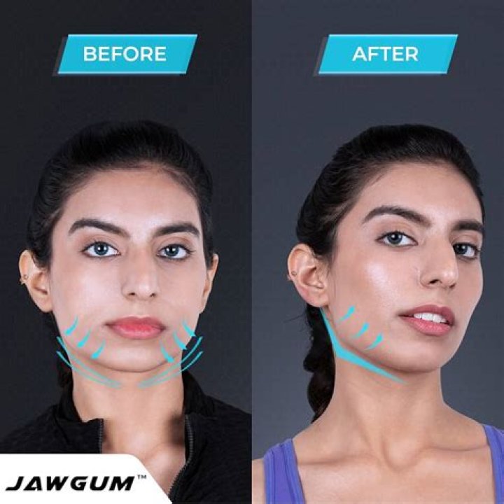 Do chewing gum reduce face fat?