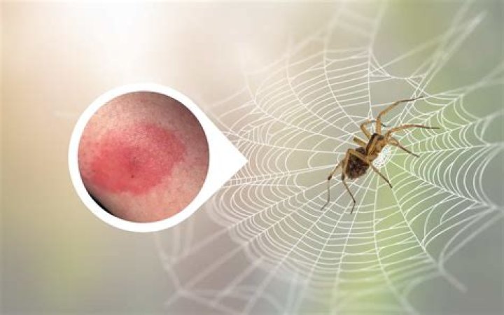 Do zipper spiders bite?