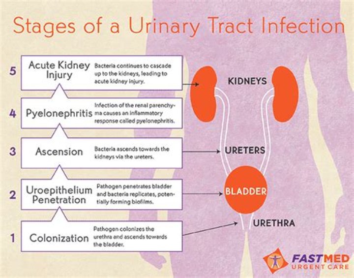 Does bladder infection show up in urinalysis?