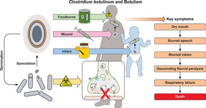 Does botulinum cause lockjaw?