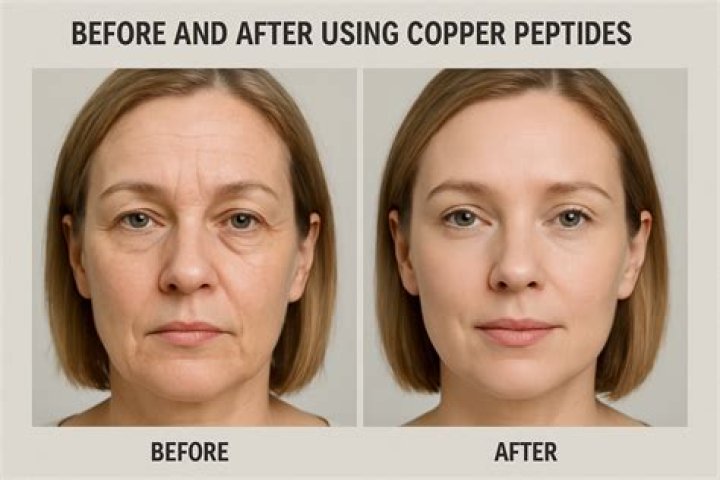 Does copper peptide serum work?