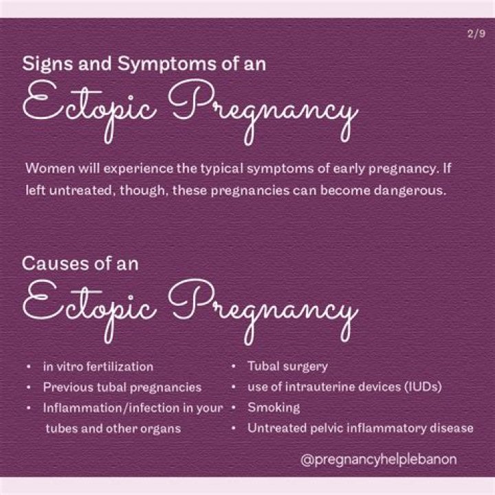 Does ectopic pregnancy survive?