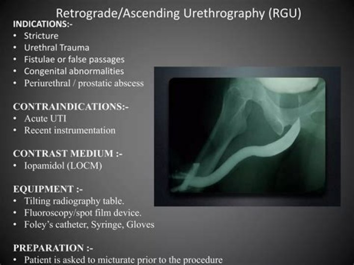 How is retrograde urethrography done?