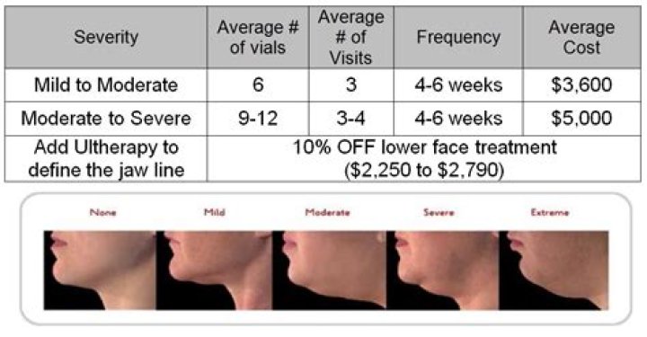 How much does kybella cost?