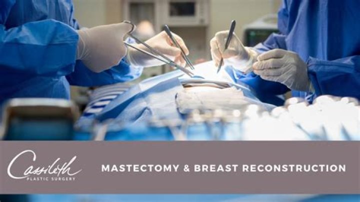 How much is breast reconstruction after mastectomy?