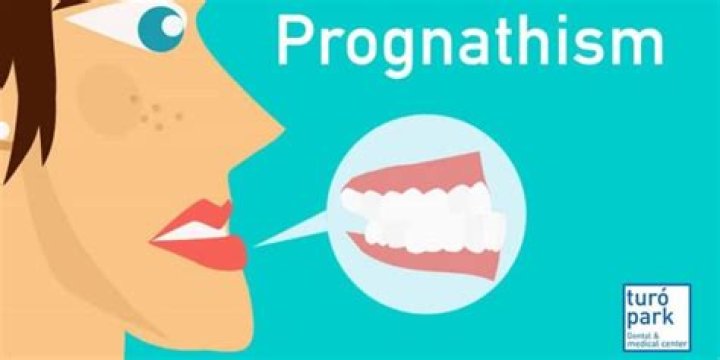 How to detect prognathism?