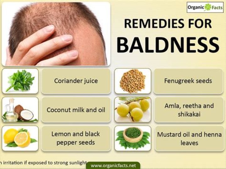 How to help balding?