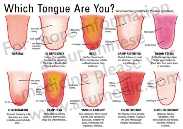 Is long tongue normal?