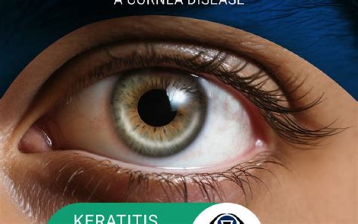 Is pigmentary keratitis dangerous?