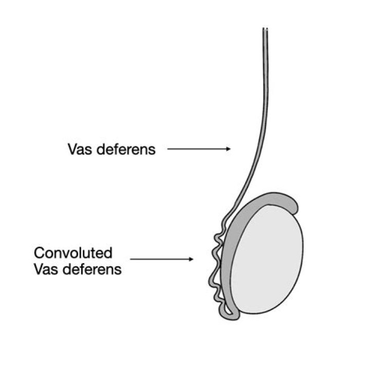 Should i be able to feel my vas deferens?