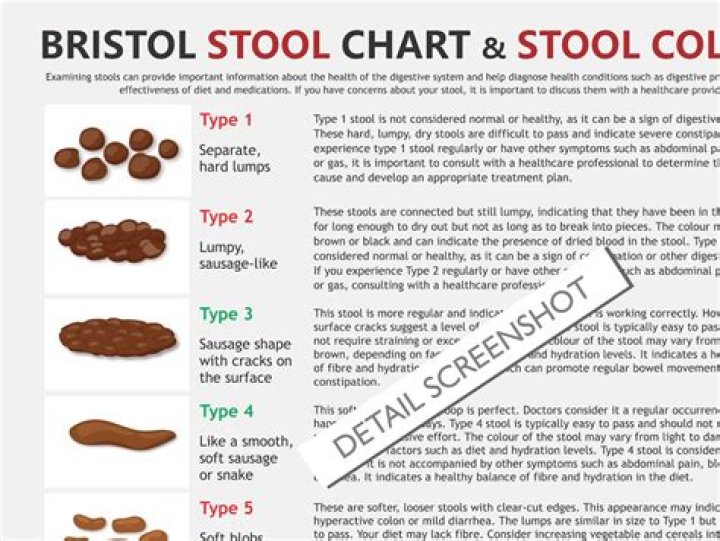 Should stools be solid?