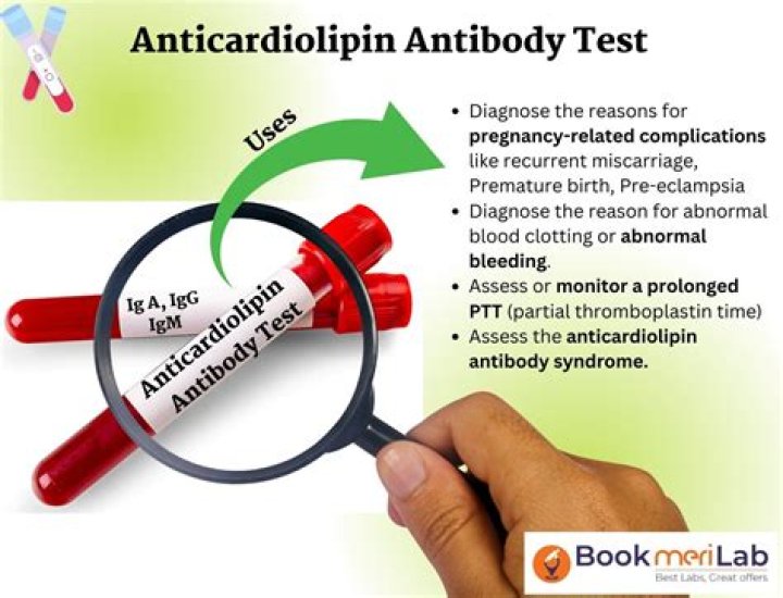 What does anticardiolipin antibody test for?