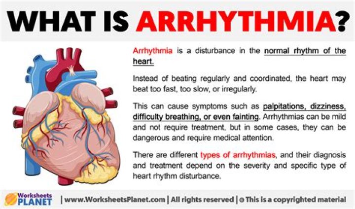 What does the word arrhythmic?