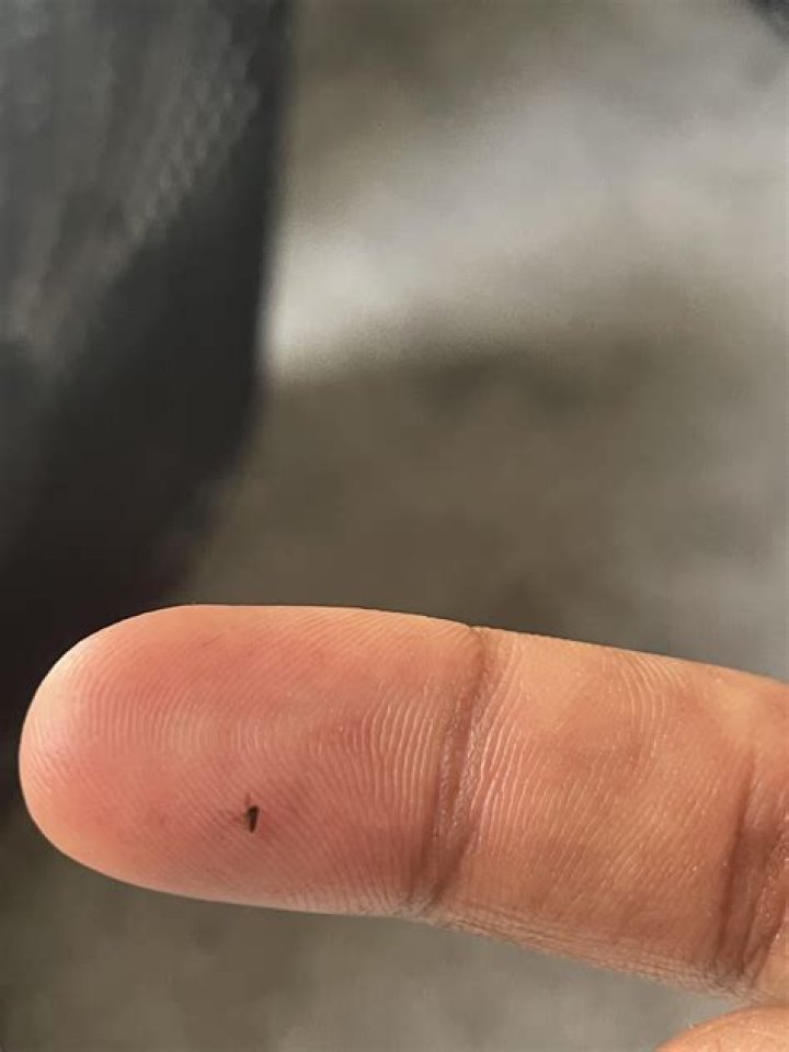 What tiny black bugs bite?