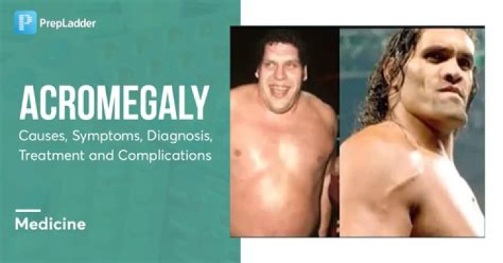 When did acromegaly start?