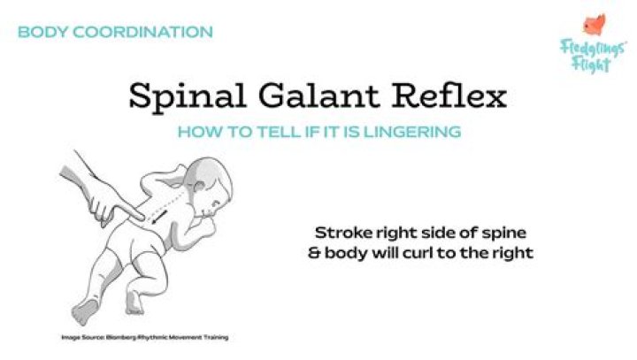 When does galant reflex disappear?