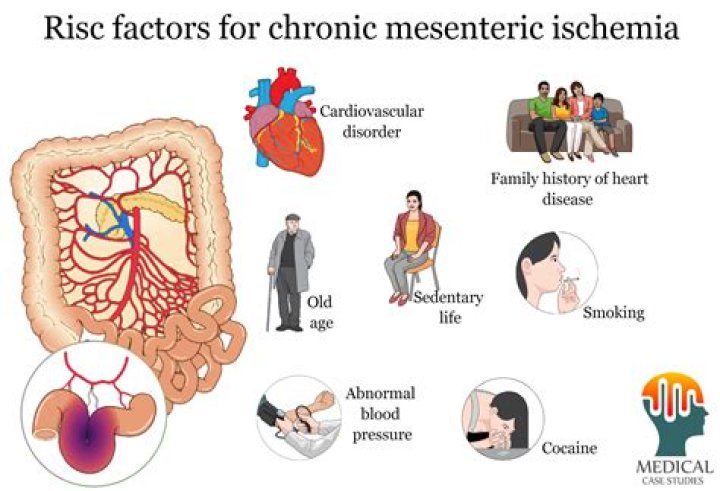 When does mesenteric ischemia occur?