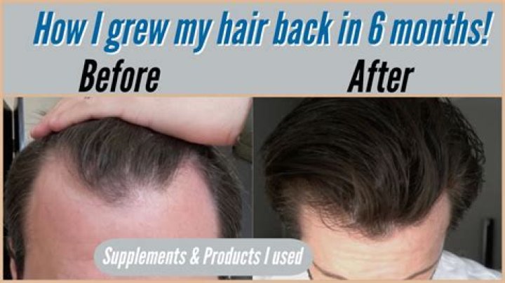 When hair sheds does it grow back?