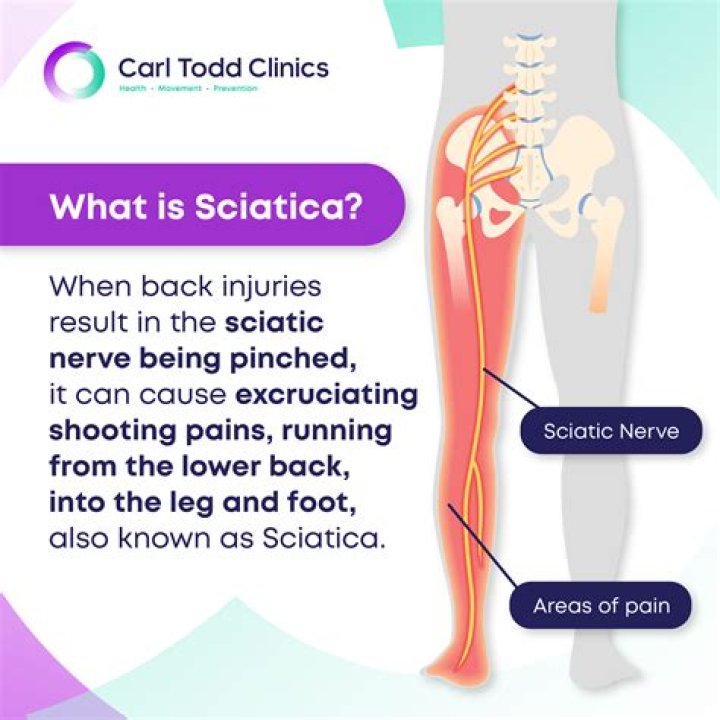 Where does a pinched sciatic nerve hurt?
