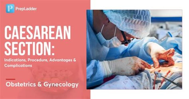 Where does the word caesarean come from?