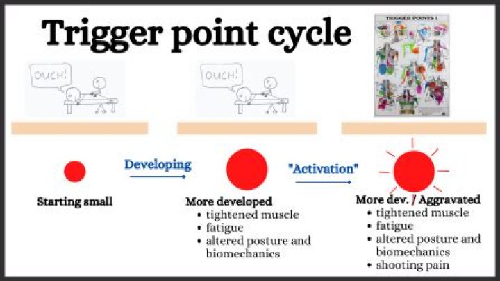 Will trigger points go away?